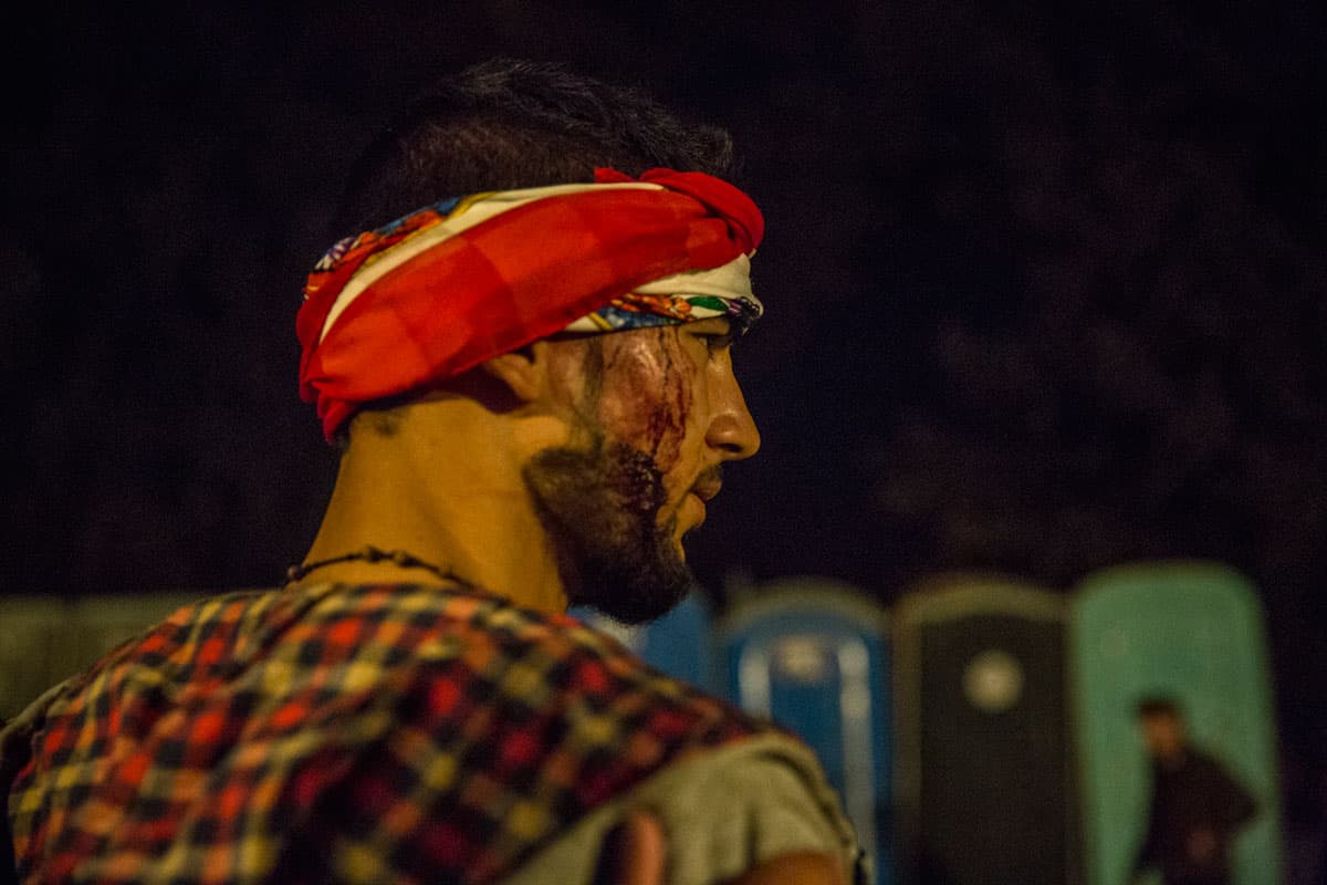 This migrant suffered injuries during the clashes at Idomeni camp.