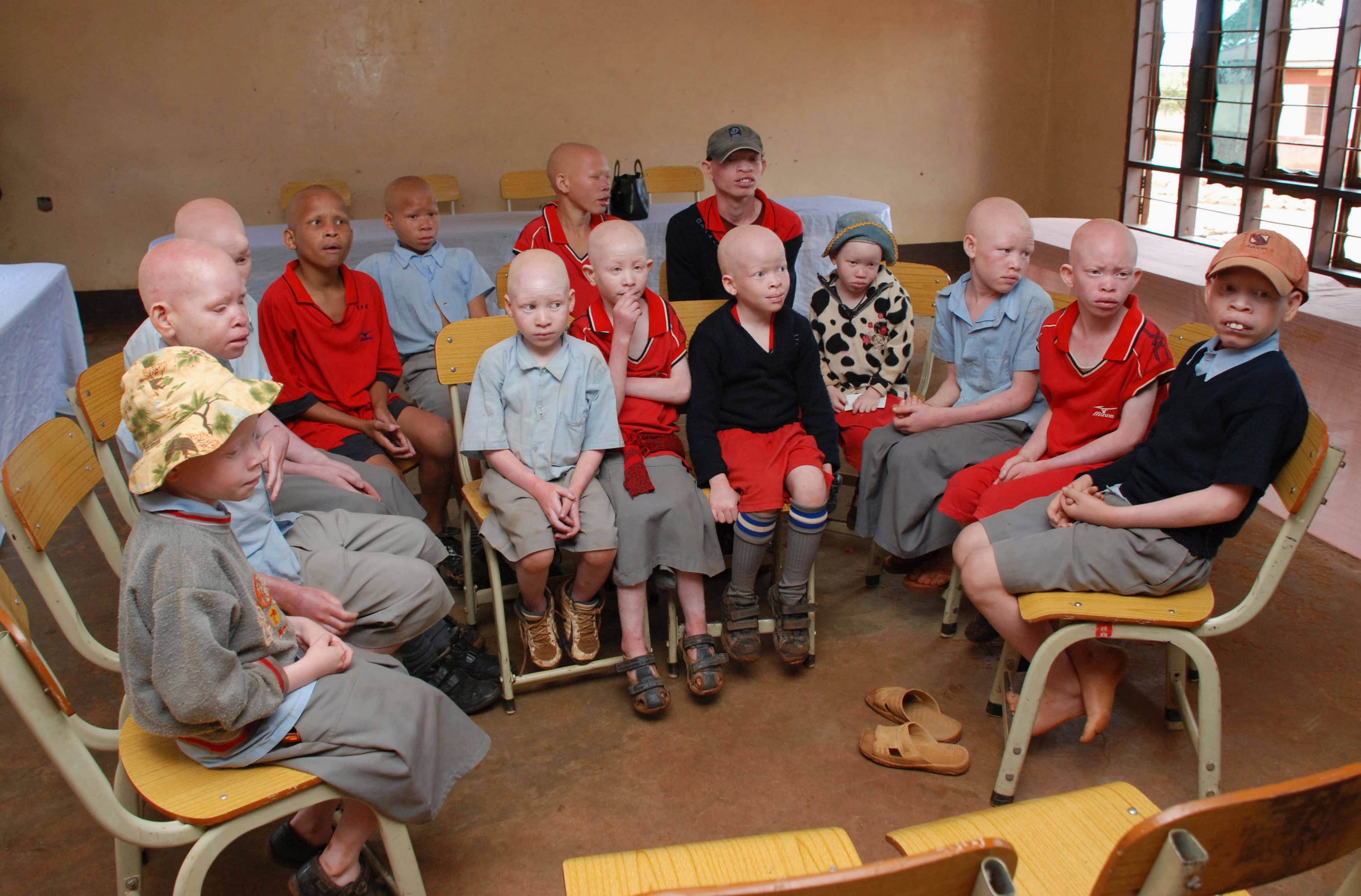 Children with albinism sit at the Golden Valley English Medium School, a school sponsored by Under the Same Sun (UTSS), in Geita November 24, 2011.