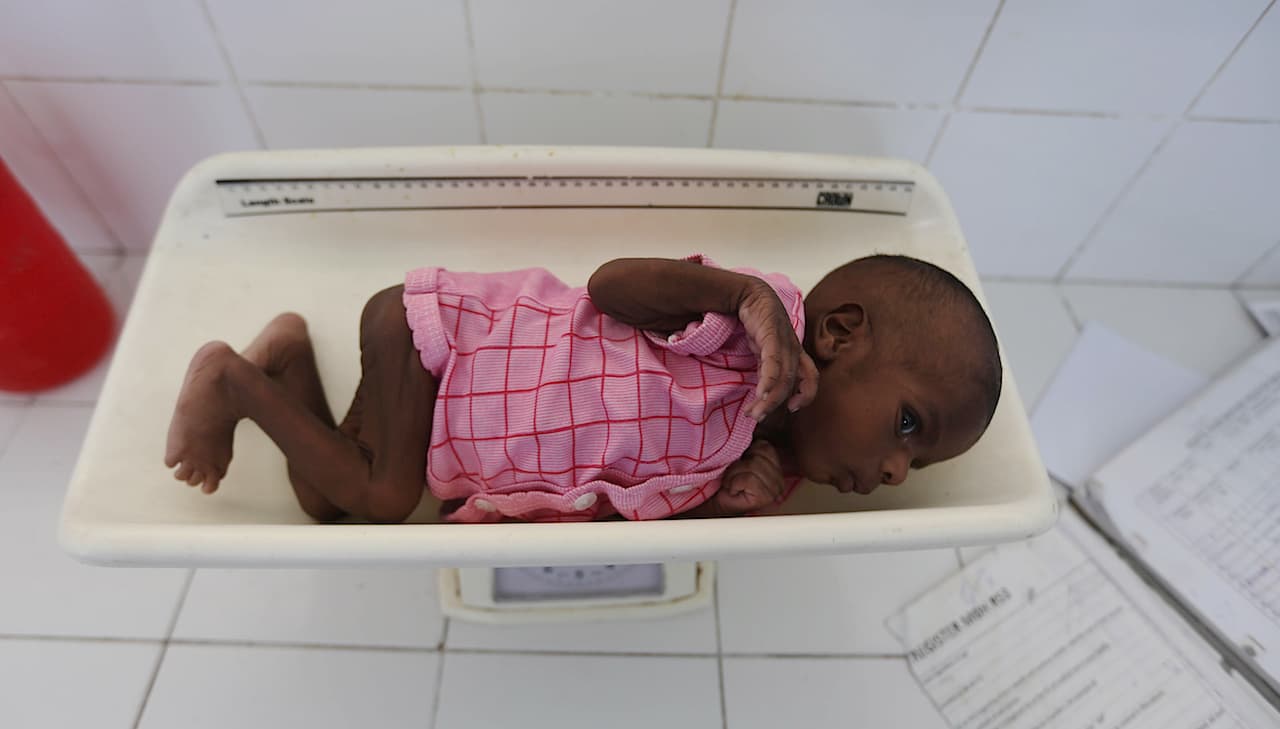 Somalia famine child