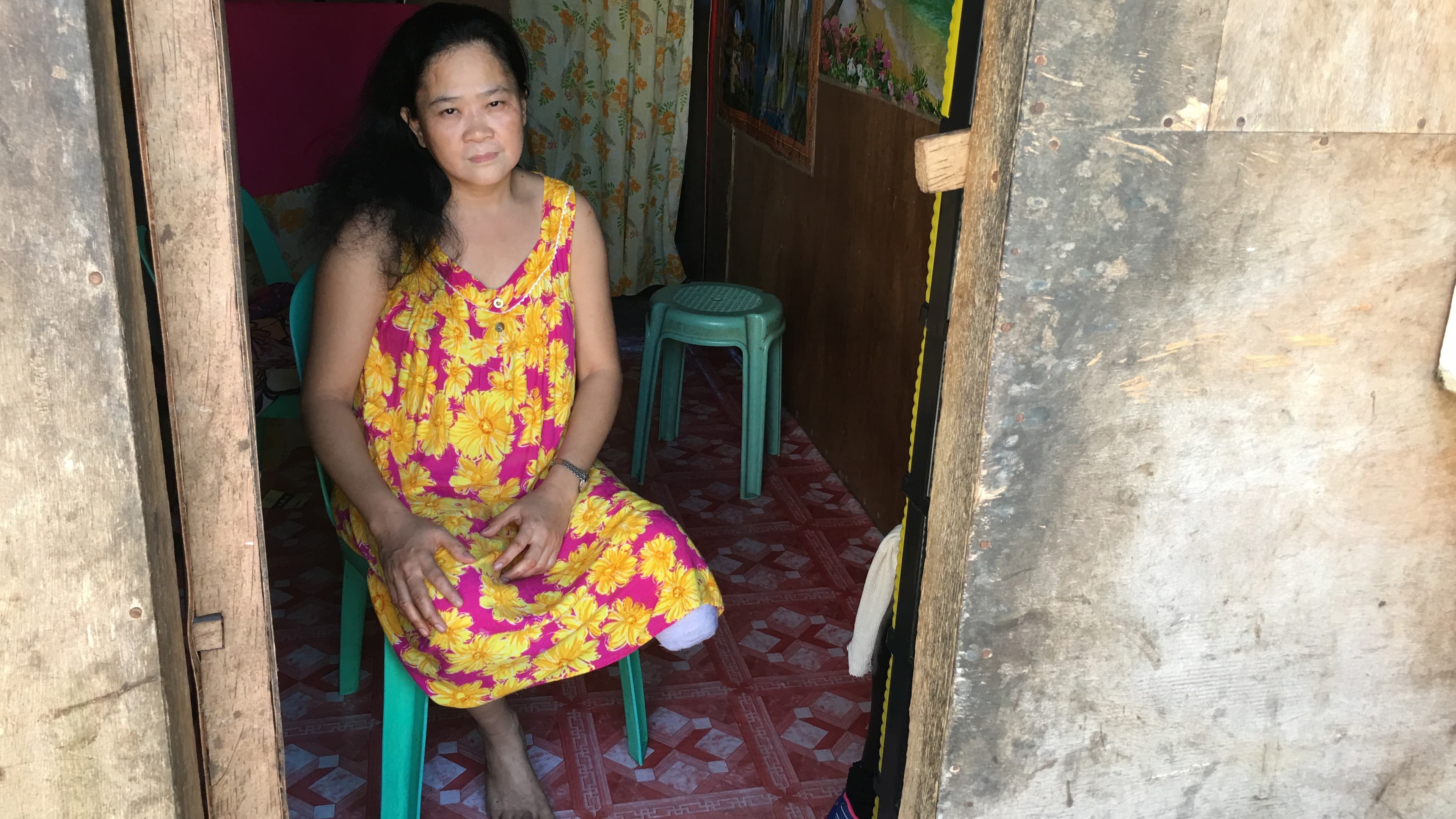 a woman with her left leg amputated at the knee sits in a doorway