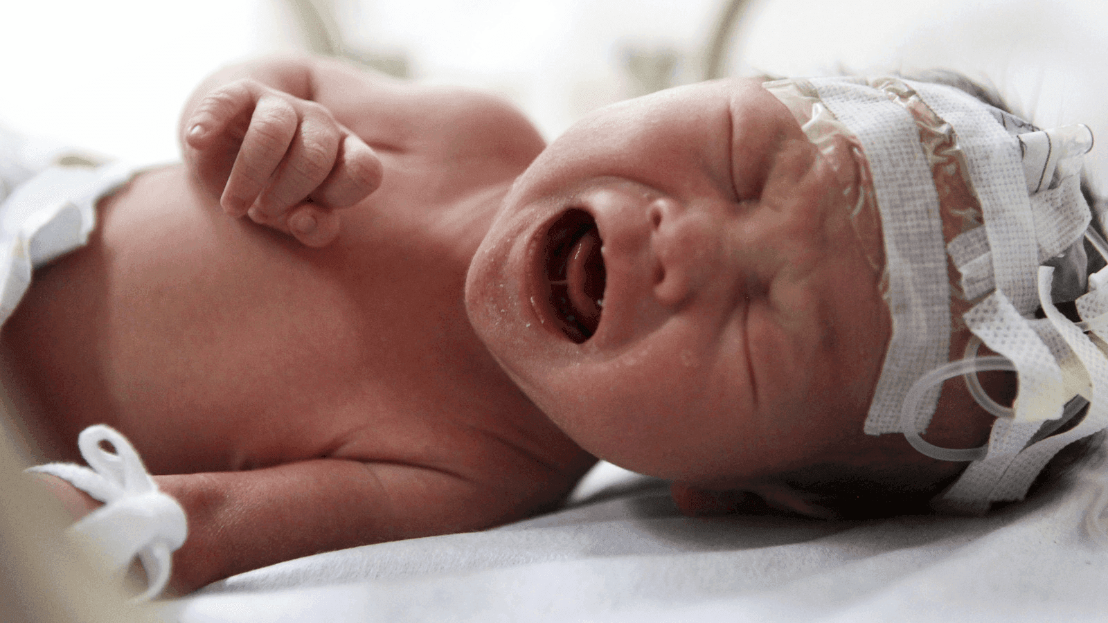a premature baby in an incubator