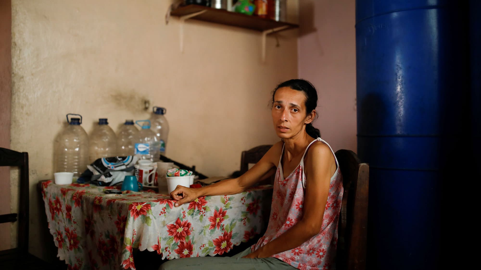 A skinny and malnourished woman poses for a picture while sitting at a table at her home in Caracas, Venezuela.