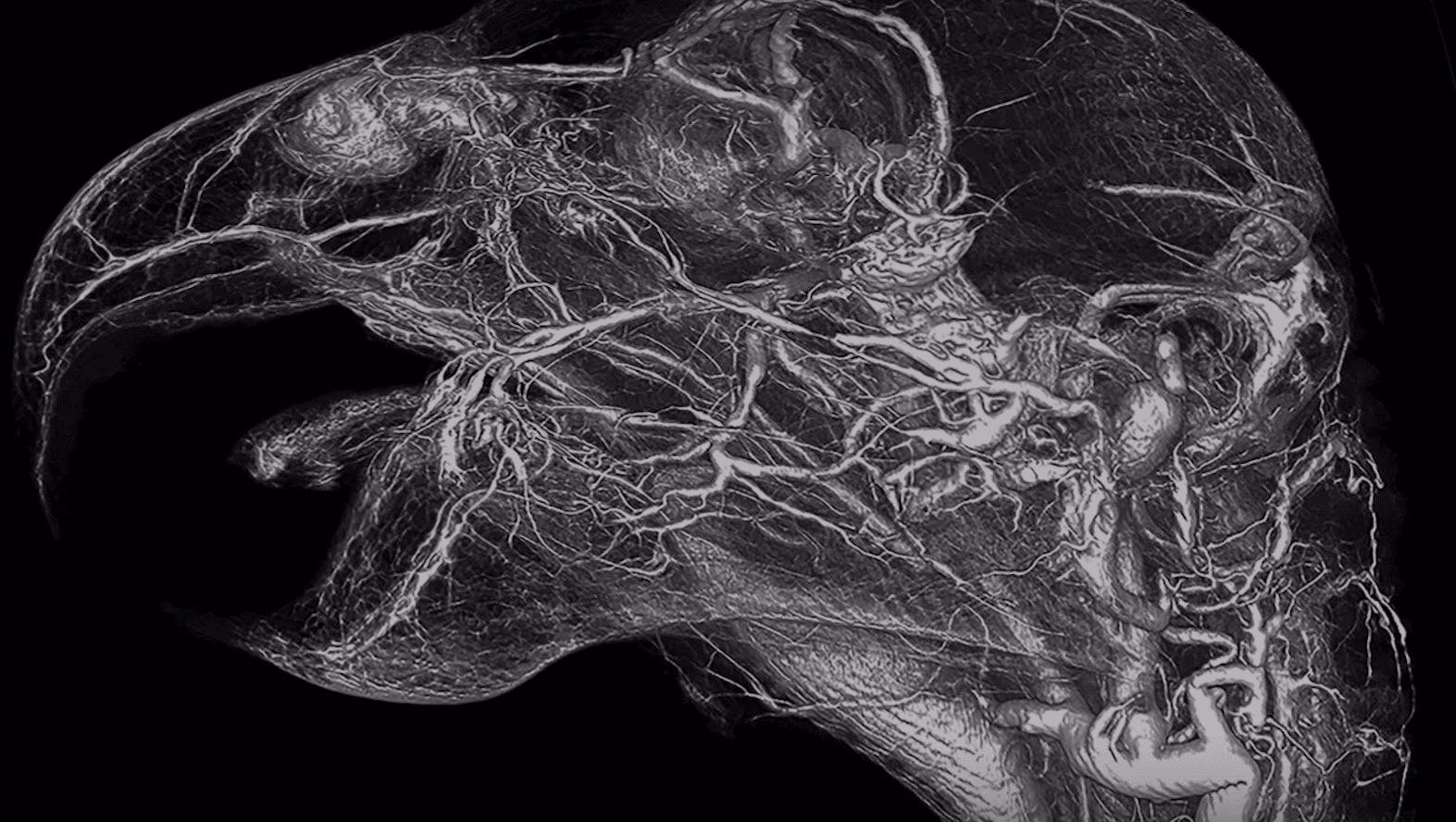 new vascular imaging models
