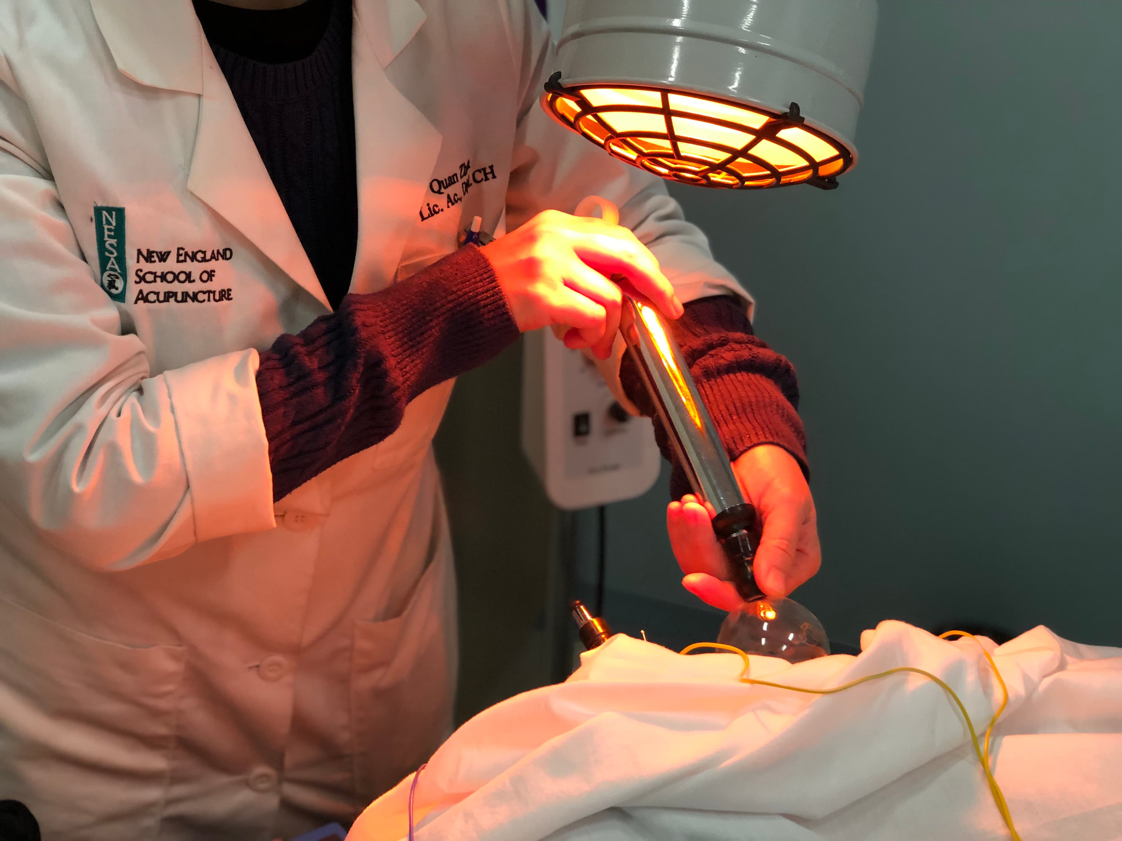 A doctor performs a cupping procedure