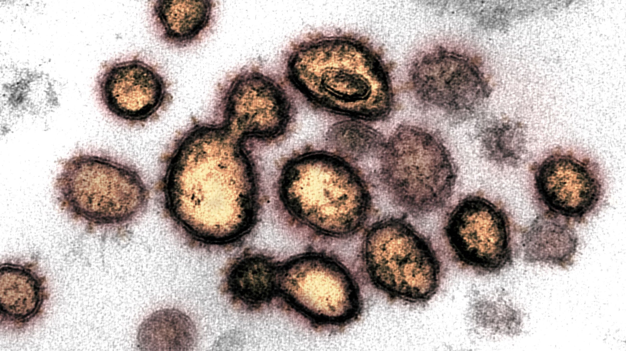 This transmission electron microscope image shows SARS-CoV-2, also known as novel coronavirus, the virus that causes COVID-19, isolated from a patient in the US. Virus particles are shown emerging from the surface of cells cultured in the lab. The spikes