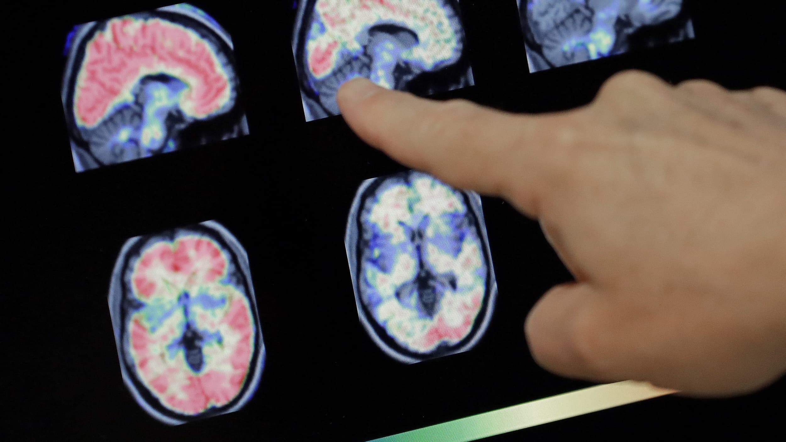 Pointing at brain scans