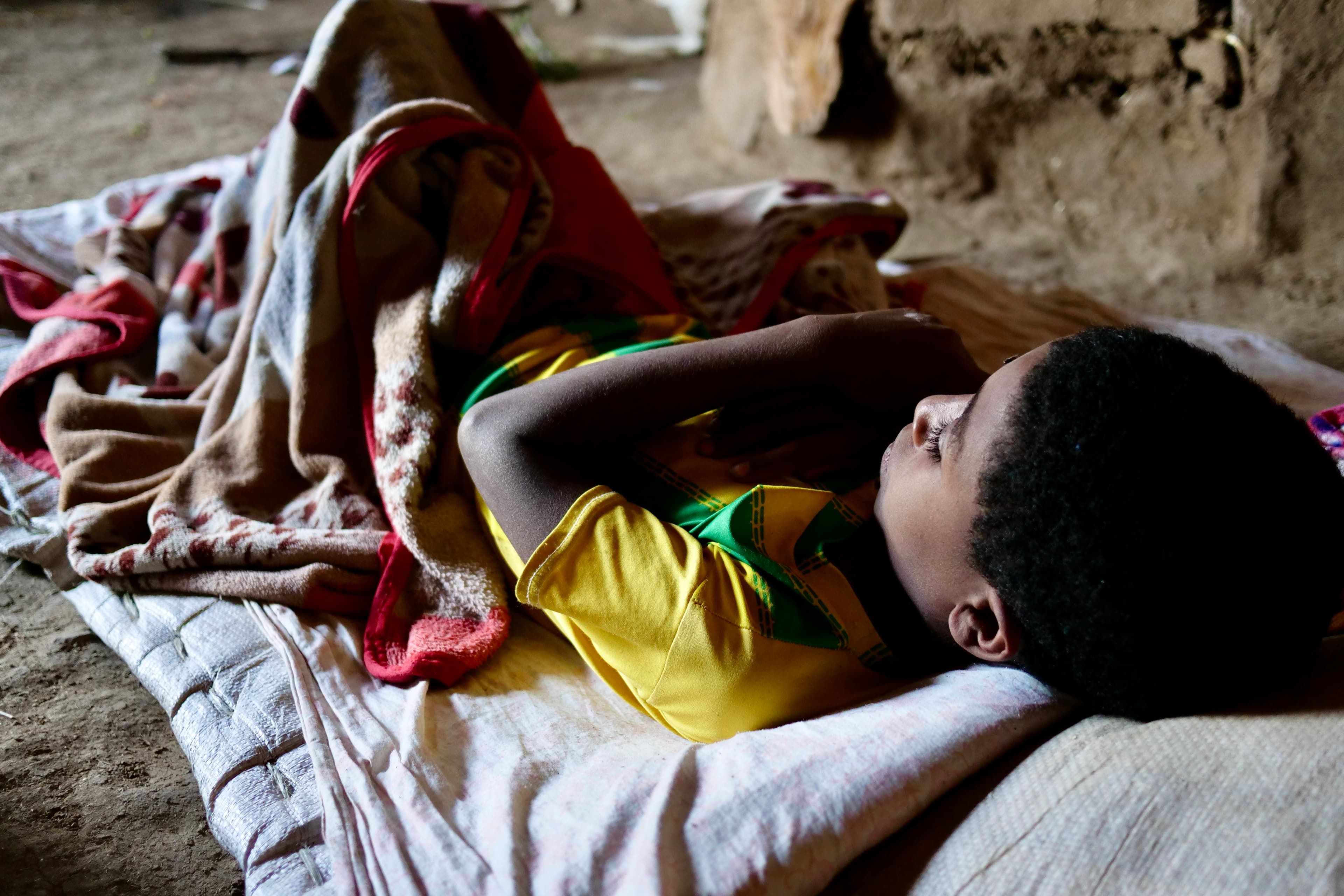 Muluken Tilahun, 12, who lost his parents and sibling during the war, is missing school due to his injuries resulting from the conflict, Feb. 17, 2022.