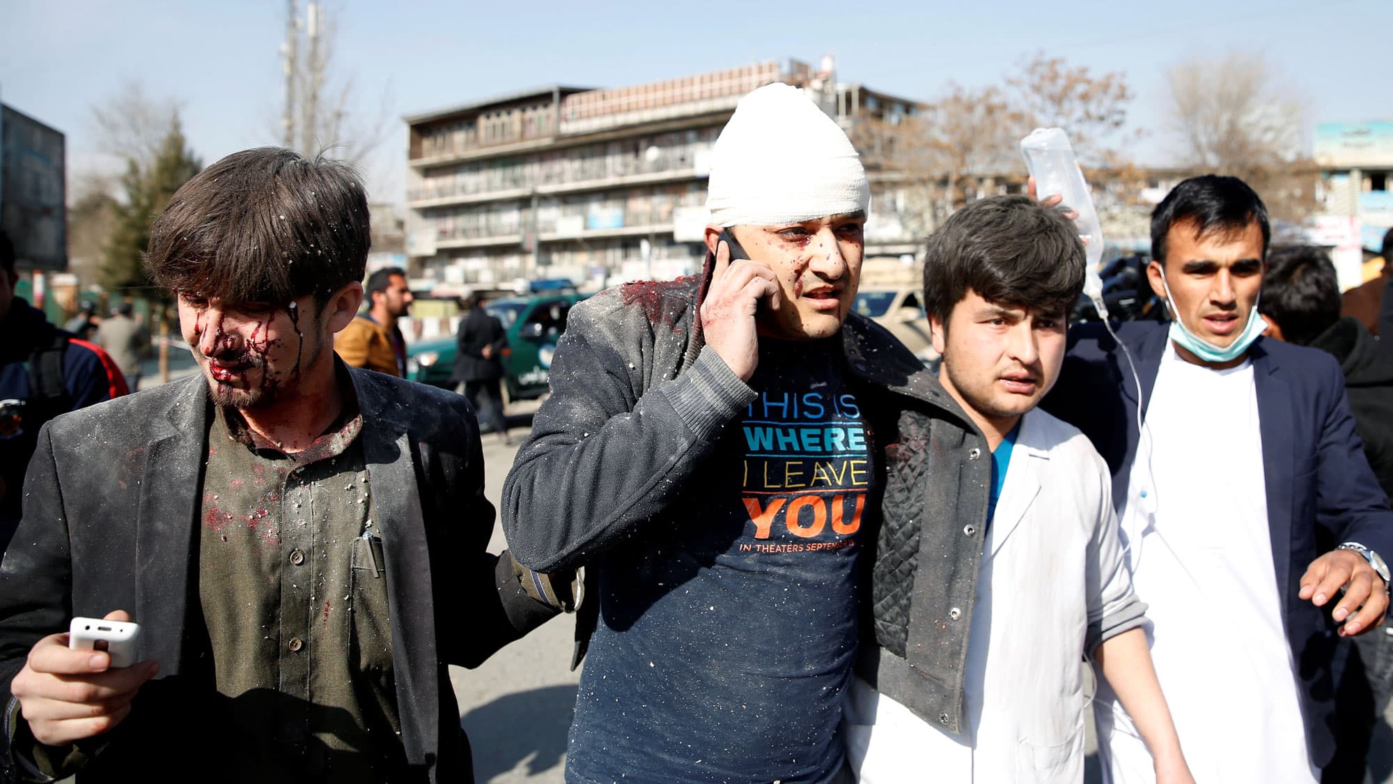 Two men are covered in dust from an explosion. One has blood on his face, the other has his head wrapped in bandages and he is on a cell phone as others help support him as he walks.