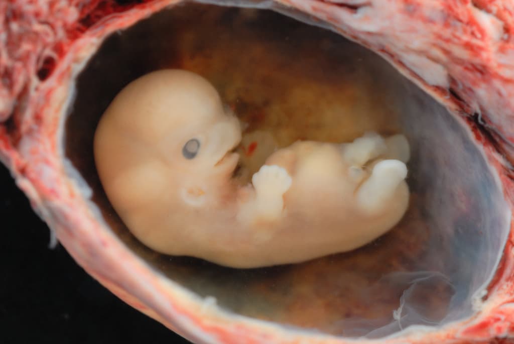 A human embryo.