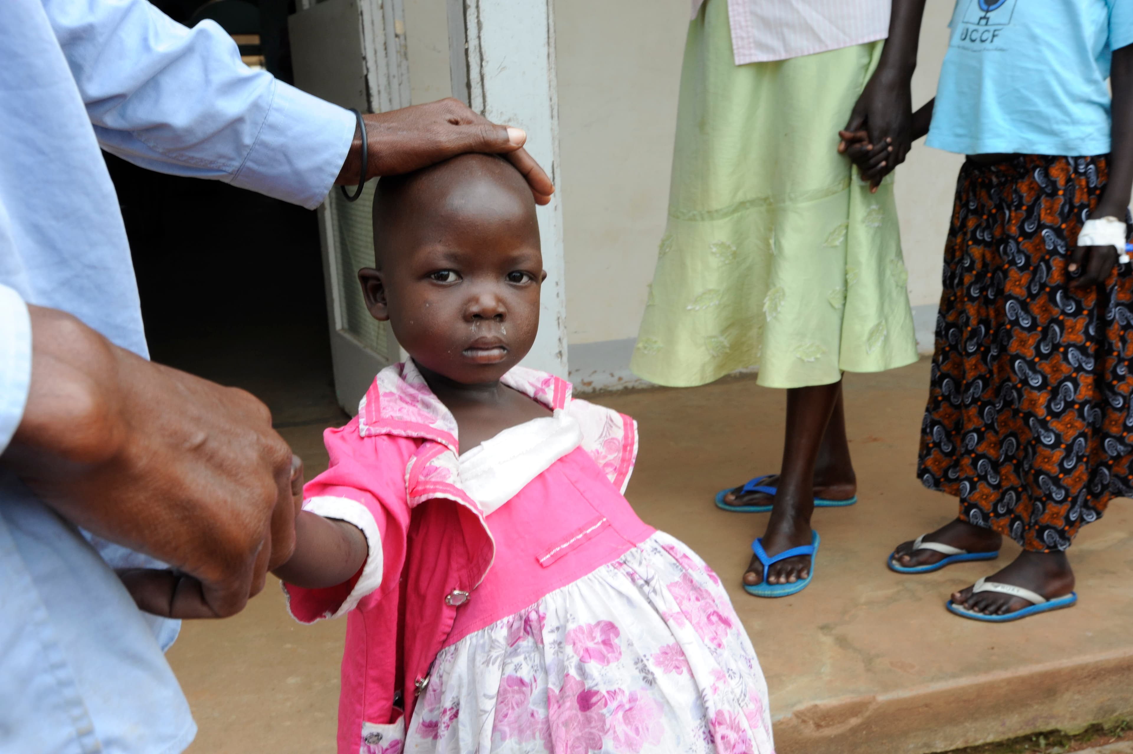 A young Burkitt's lymphoma patient.