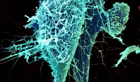 An electron microscope image of the string-like Ebola virus. Scientists at the NIH are working quickly on a drug and vaccine they hope will halt the spread of Ebola.