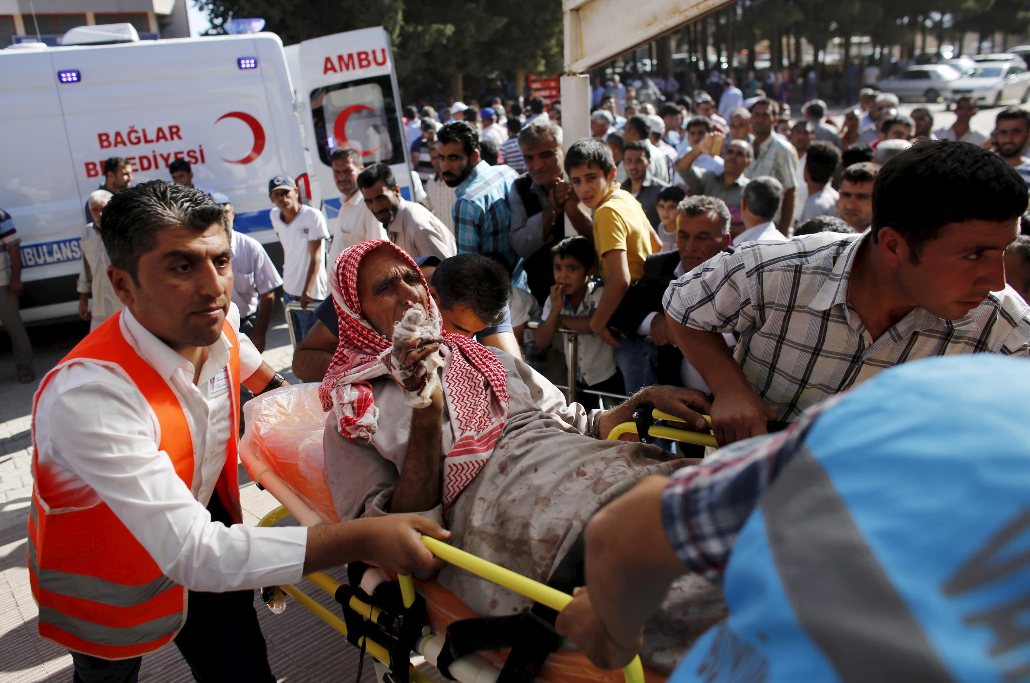 An injured man from the Syrian town of Kobane is carried to a hospital in Turkey, after forces of the so-called Islamic State raided Kobane.