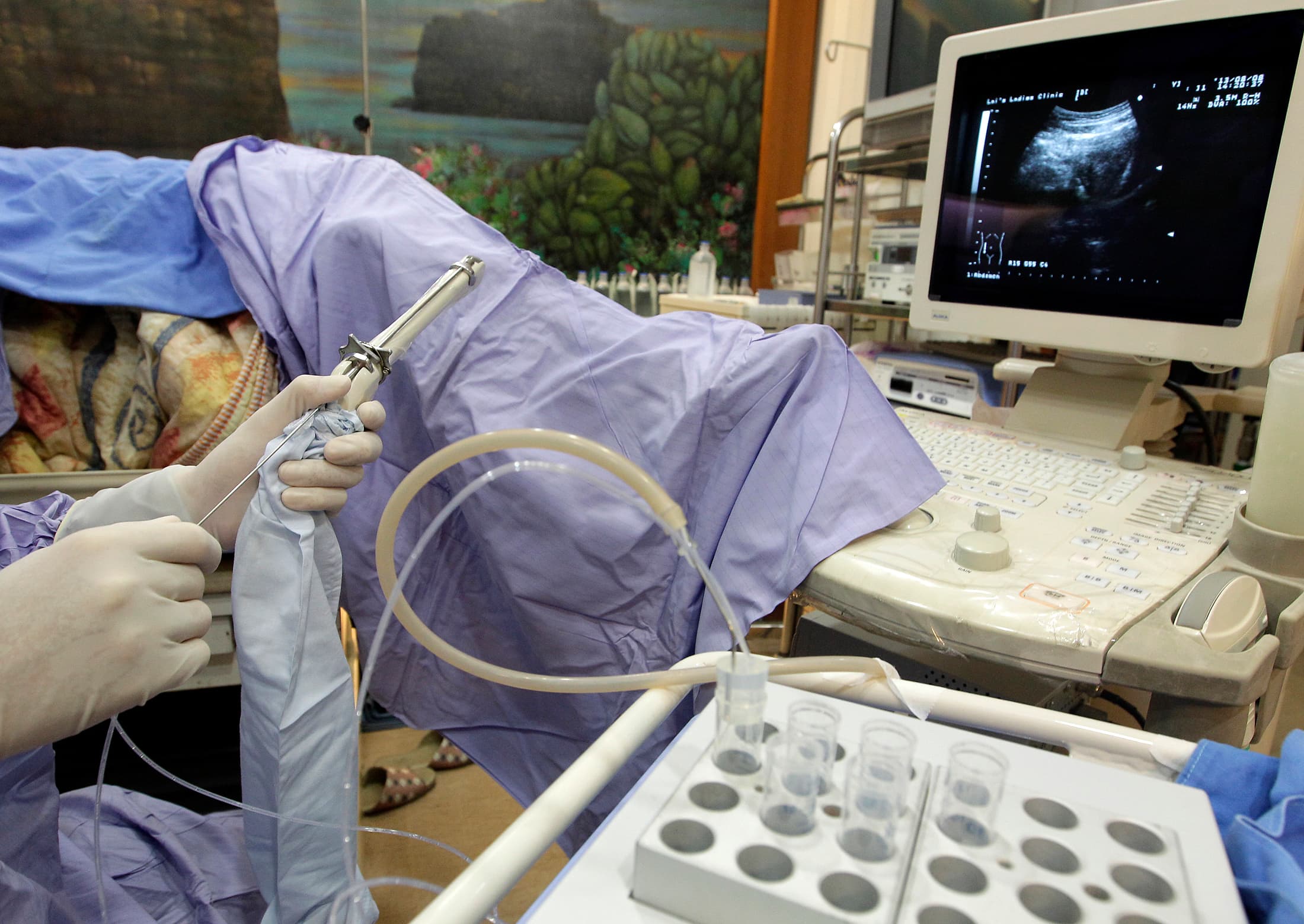 An employee demonstrates the preparation to take eggs with a needle at the e-Stork Reproductive Center in Hsinchu in northern Taiwan.