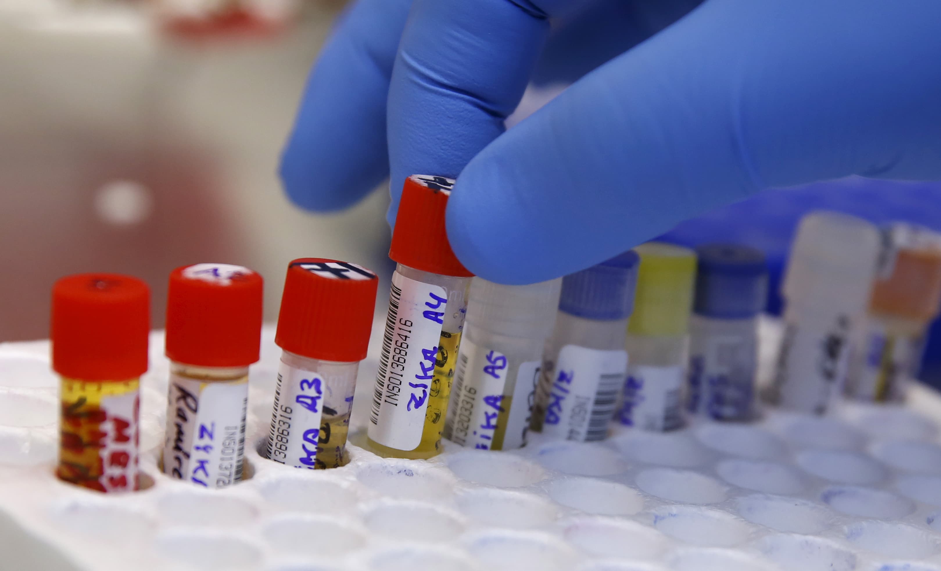 A health technician analyzes blood samples from patients bitten by mosquitoes at the National Institute of Health in Lima, Peru.