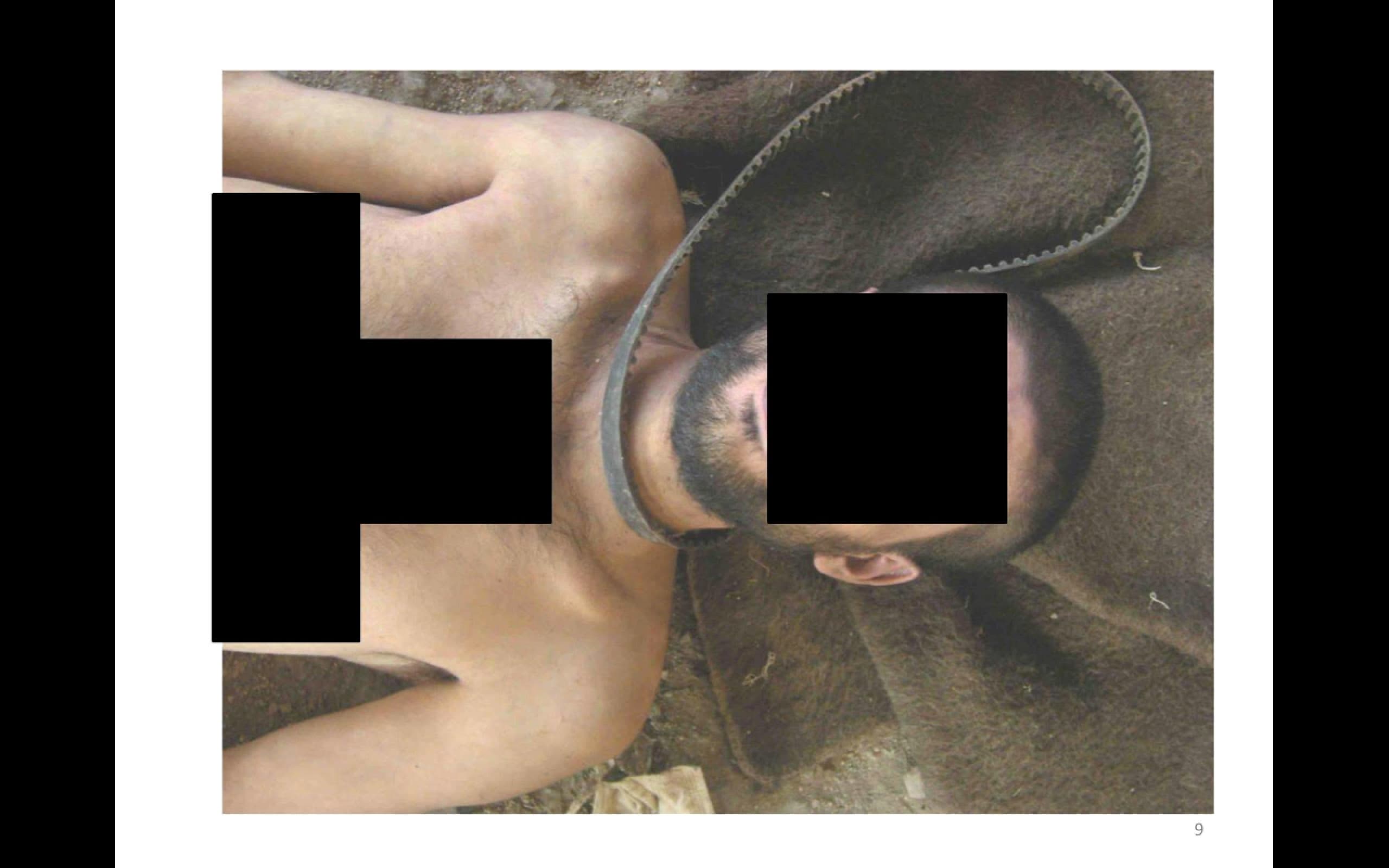 Leaked pictures from a man who allegedly served as a military police and was tasked with photographing the dead bodies brought to the military hospitals controlled by the Syrian regime during the civil war.